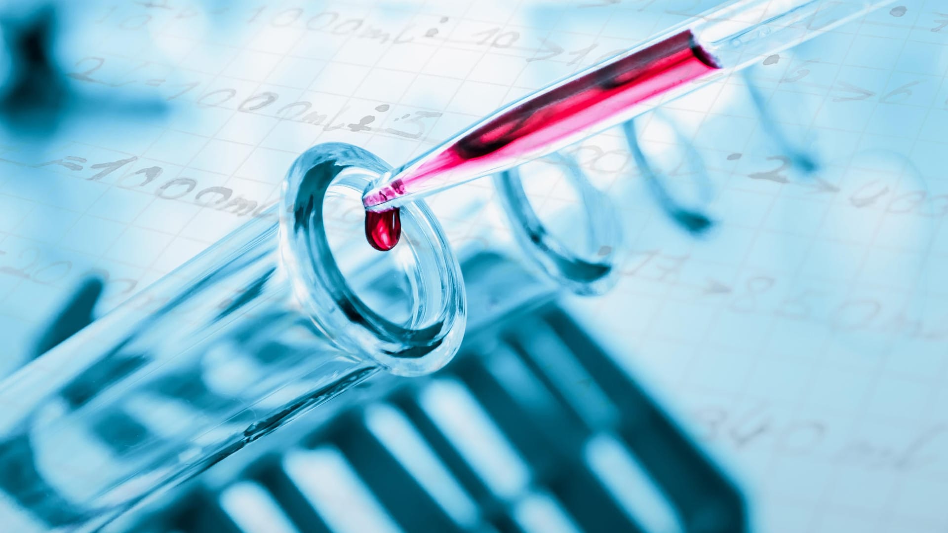 Down-Syndrom: Ein Bluttest bei Schwangeren zeigt, ob beim Ungeborenen eine Genmutation wie Trisomie 21 vorliegt. Down-Syndrom: Ein Bluttest bei Schwangeren zeigt, ob beim Ungeborenen eine Genmutation wie Trisomie 21 vorliegt.