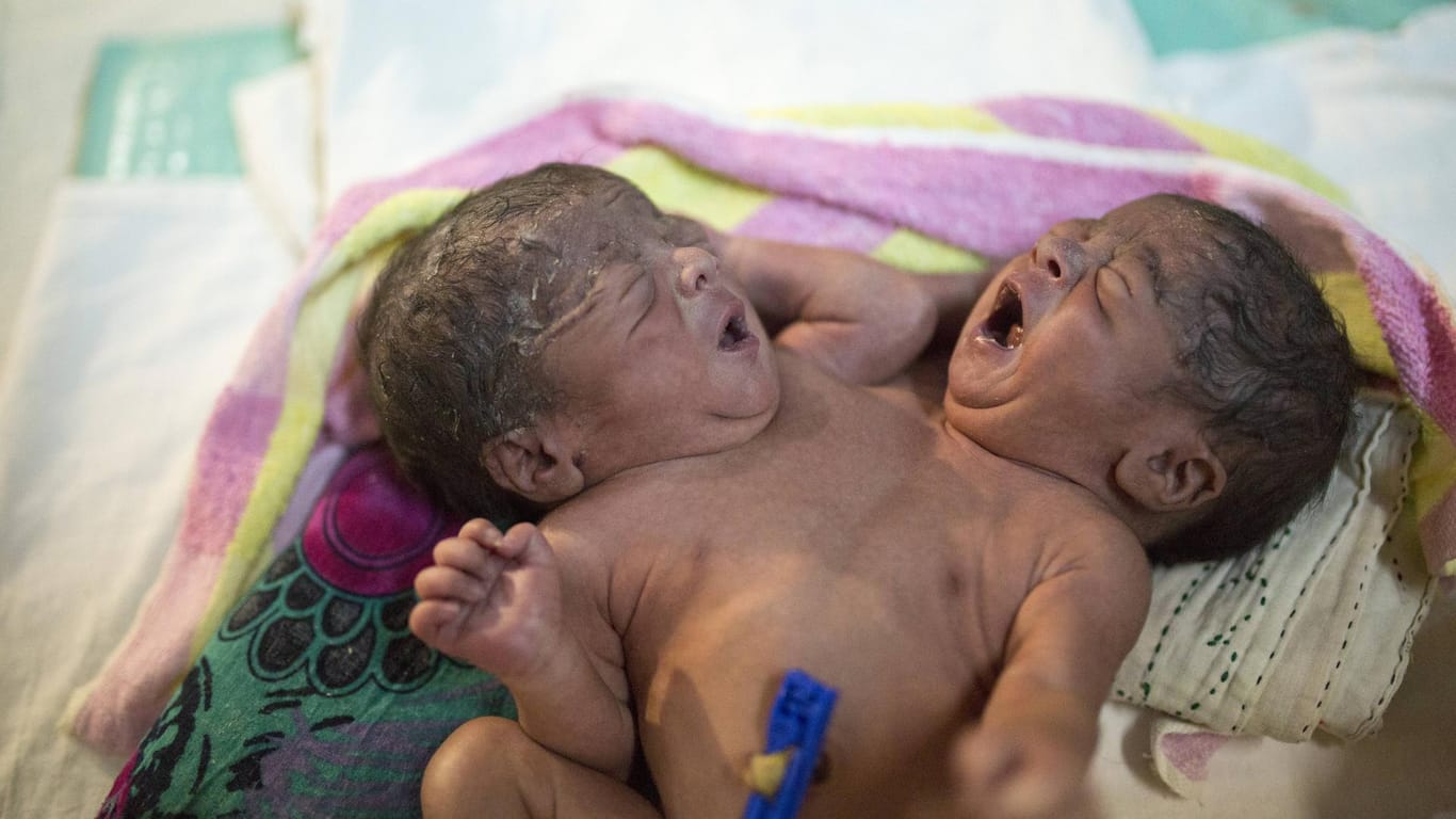 Kurz nach ihrer Geburt wurden diese siamesische Zwillinge von ihren Eltern in einer Säuglingsstation in Dhaka (Bangladesh) ausgesetzt.
