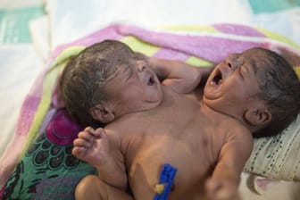 Kurz nach ihrer Geburt wurden diese siamesische Zwillinge von ihren Eltern in einer Säuglingsstation in Dhaka (Bangladesh) ausgesetzt.