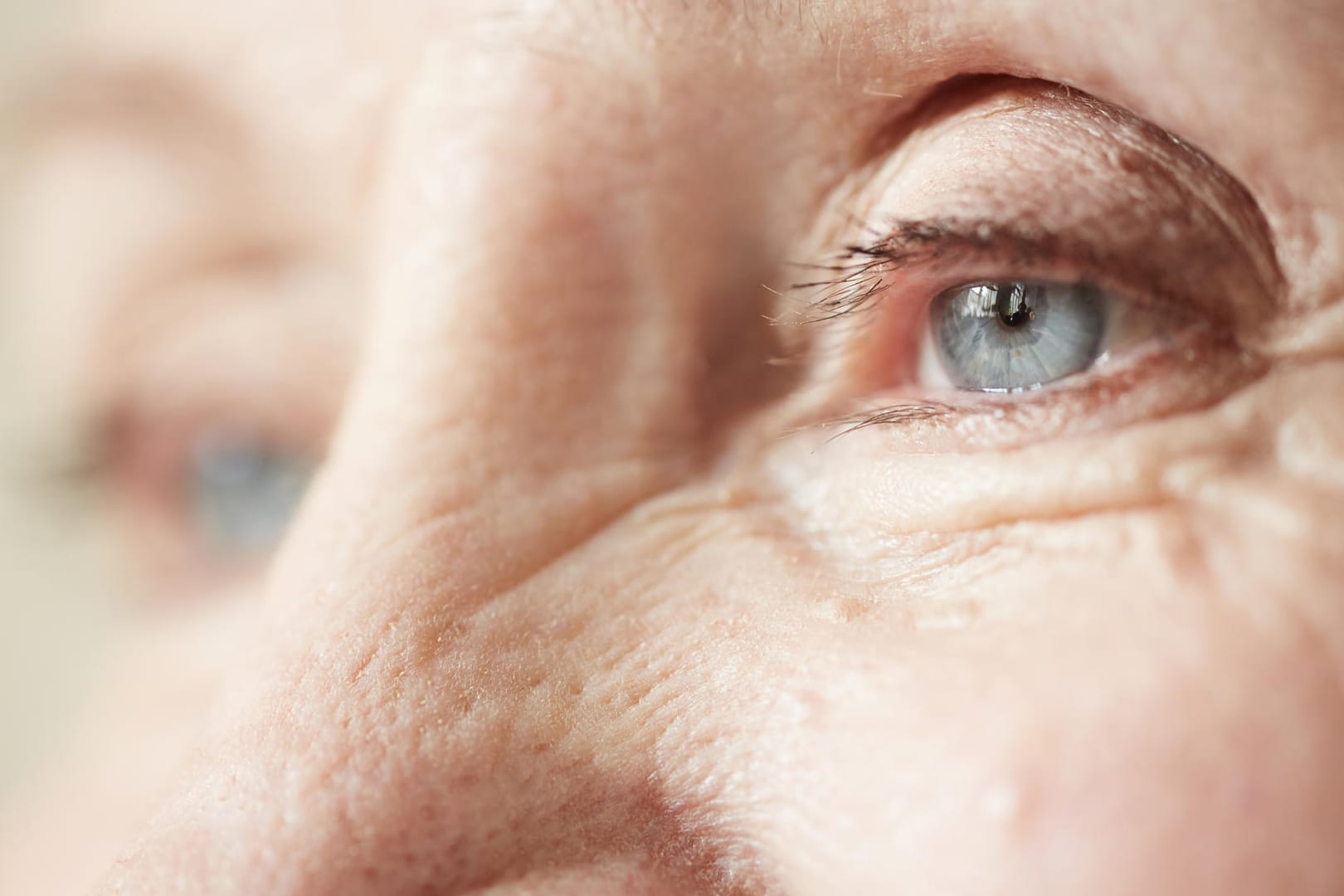 Weißliche Ringe auf der Hornhaut können auf einen erhöhten Cholesterinspiegel hinweisen und sollten vom Arzt abgeklärt werden.