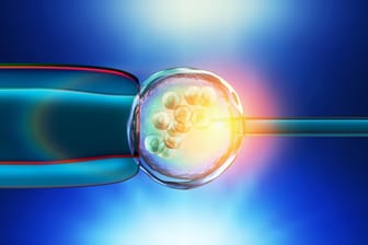 3-D-Illustration einer In-vitro-Fertilisation.