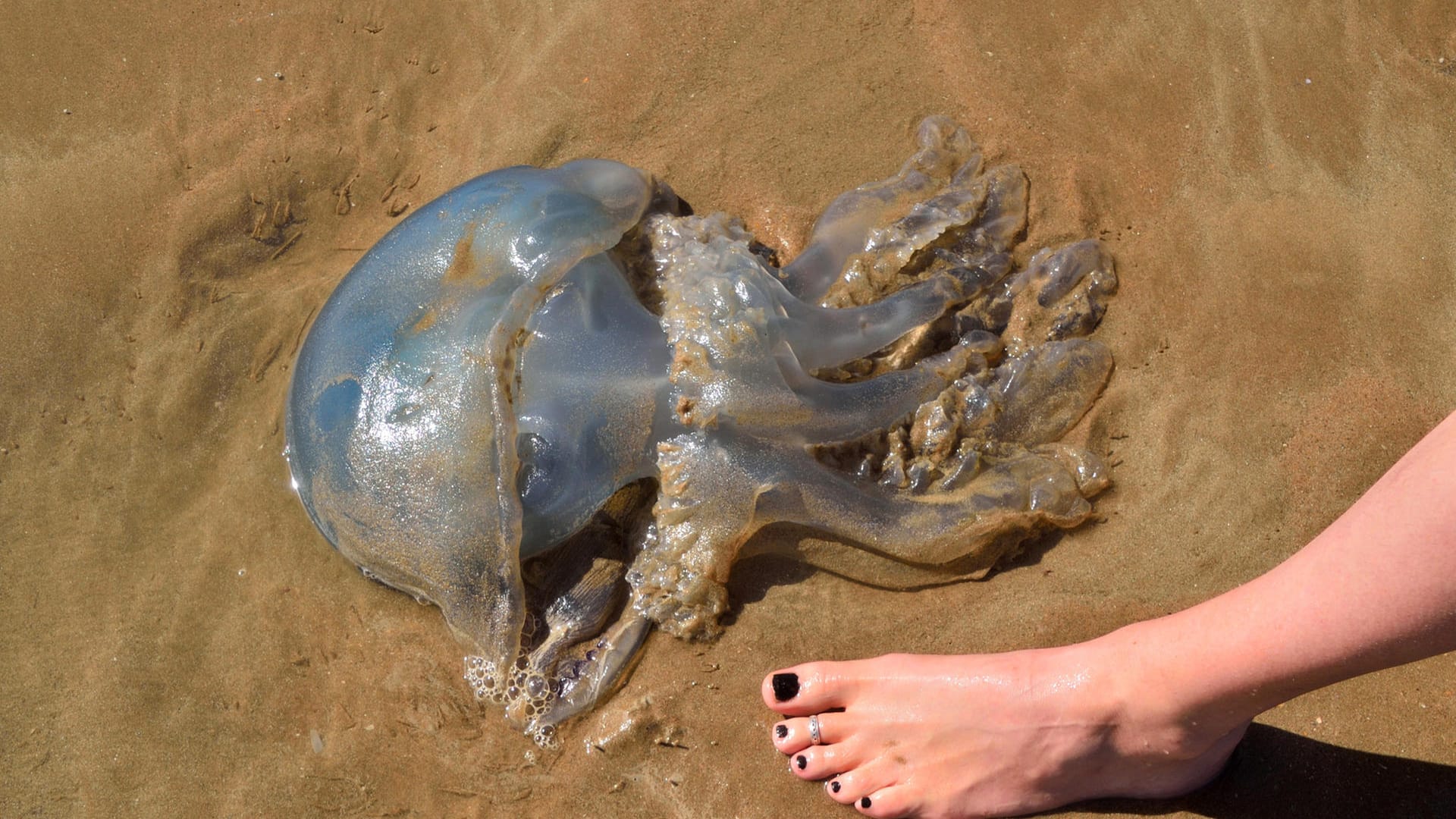 Qualle am Strand: Nicht alle Quallen verursachen starke Verletzungen.