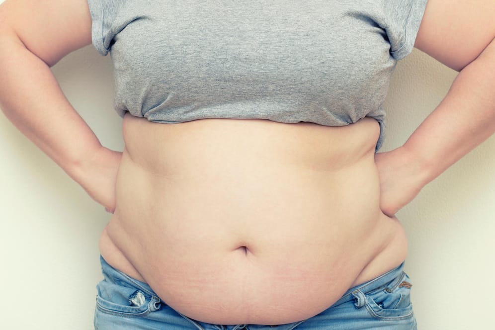 Adipositas: Eine Magenverkleinerung kann helfen.