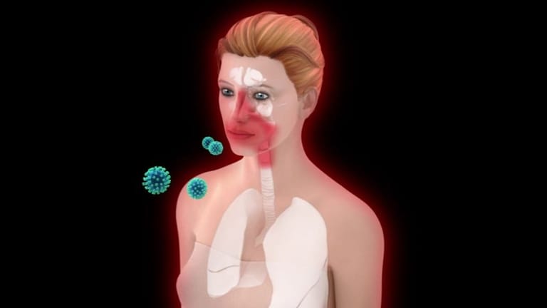 Der Screenshot zeigt einen Teil der interaktiven Grafik, mit der das Bundesgesundheitsministerium den Verlauf einer Coronavirus-Infektion erklärt.