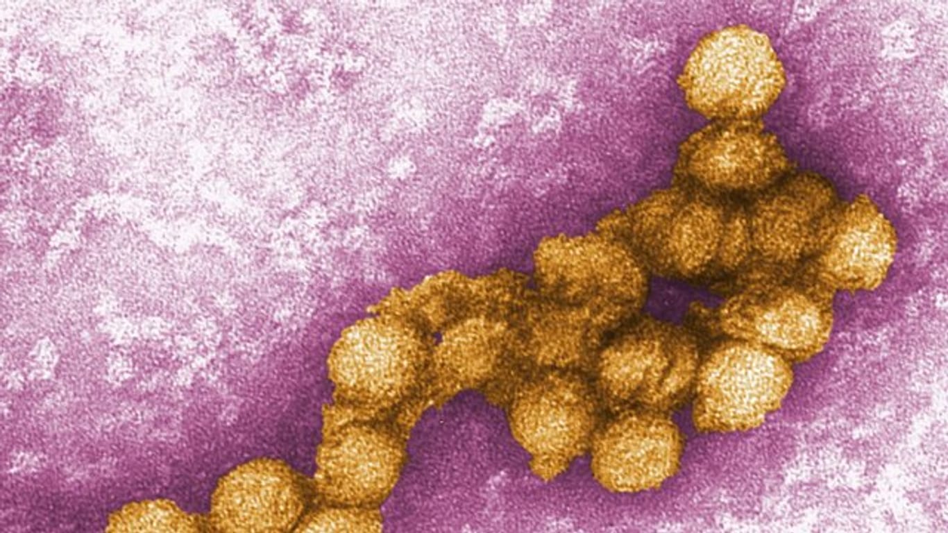Das West-Nil-Virus unter dem Elektronenmikroskop