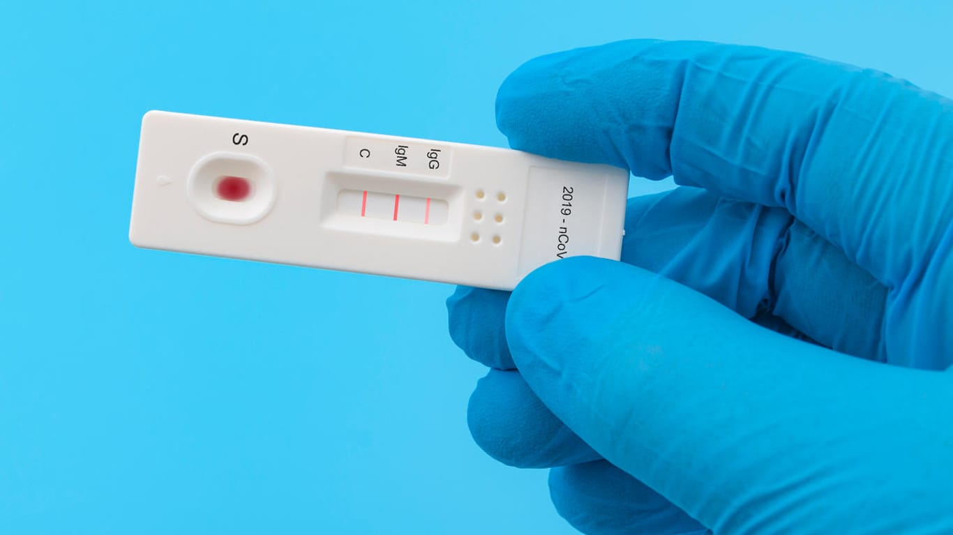 Corona-Test: Antigen-Test sollen das positive oder negative Ergebnis innerhalb von Minuten anzeigen. (Symbolbild)