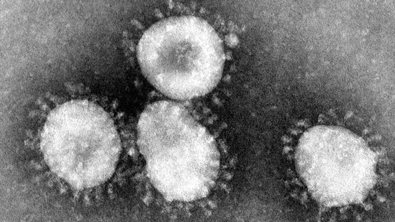 Ein Coronavirus unter dem Mikroskop (Archivbild): In Erfurt hat es einen Corona-Fall an einer Einrichtung für Menschen mit Behinderung gegeben.