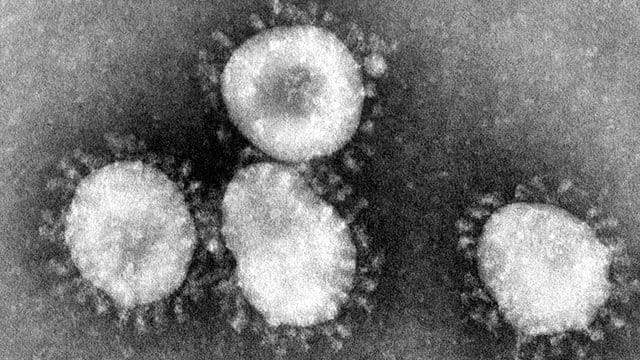 Ein Coronavirus unter dem Mikroskop (Archivbild): In Erfurt hat es einen Corona-Fall an einer Einrichtung für Menschen mit Behinderung gegeben.