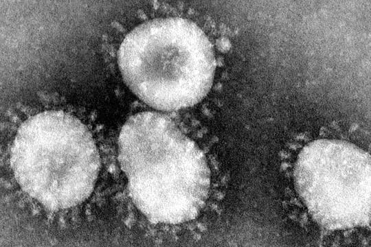 Ein Coronavirus unter dem Mikroskop (Archivbild): In Erfurt hat es einen Corona-Fall an einer Einrichtung für Menschen mit Behinderung gegeben.