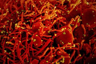 Auf dieser vom US-Forschungszentrum "National Institute of Allergy and Infectious Diseases" (NIAID) zur Verfügung gestellten Aufnahme ist eine Zelle (rot) mit dem Coronavirus (SARS-CoV-2, gelb) infiziert.