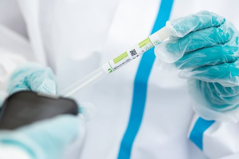 Ein medizinischer Mitarbeiter hält ein Teströhrchen in der Hand