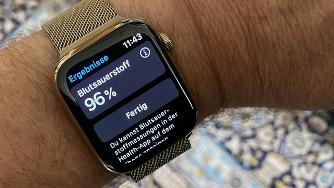 Die Apple Watch Series 6 kann Puls und Blutsauerstoff messen und auch ein EKG erstellen.