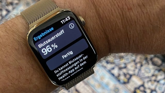 Die Apple Watch Series 6 kann Puls und Blutsauerstoff messen und auch ein EKG erstellen.