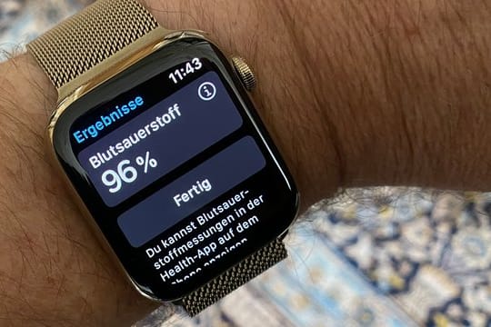 Die Apple Watch Series 6 kann Puls und Blutsauerstoff messen und auch ein EKG erstellen.