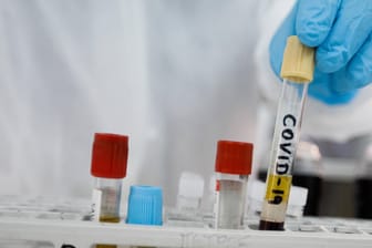 Ein Forschungslabor bei der Arbeit mit dem Covid-19 Virus (Symbolbild): Ein Antikörper-Cocktail soll US-Präsident Donald Trump zur Genesung verholfen haben.