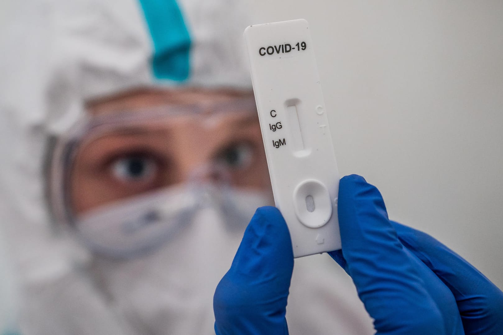 Corona-Test: Sogenannte Antigen-Schnelltests sollen schnellere Ergebnisse ermöglichen.