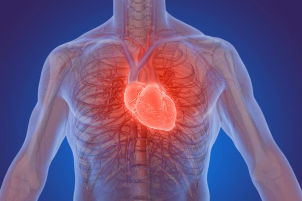 Herz: Die mildeste Ausprägung des akuten Koronarsyndroms ist die instabile Angina pectoris.
