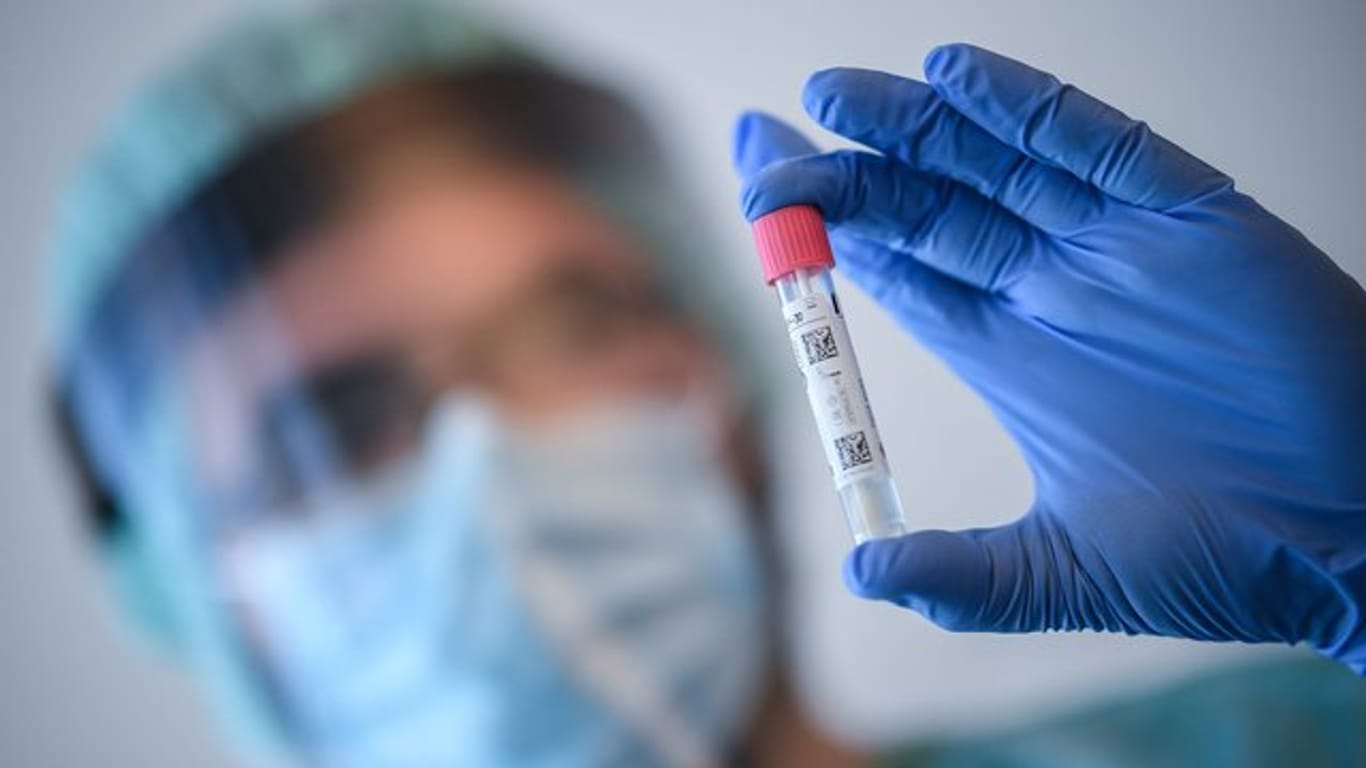 Ein Arzt führt Untersuchungen zum Coronavirus durch