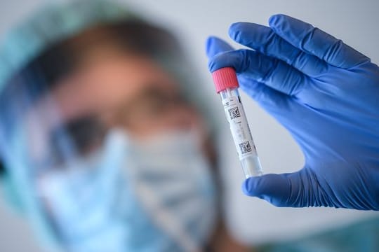 Ein Arzt führt Untersuchungen zum Coronavirus durch