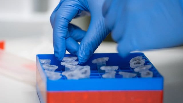 Eine Laborantin führt Untersuchungen zum Coronavirus durch (Symbolbild). In Berlin sind die Neuinfektionen erneut gestiegen. Eine Laborantin führt Untersuchungen zum Coronavirus durch (Symbolbild). In Berlin sind die Neuinfektionen erneut gestiegen.