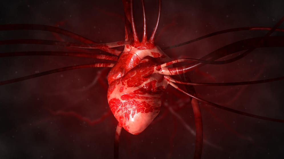 Ein verdickter Herzmuskel führt zu einer starken Belastung des Herzens. Damit es nicht zu einer Herzschwäche kommt.
