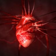 Ein verdickter Herzmuskel führt zu einer starken Belastung des Herzens. Damit es nicht zu einer Herzschwäche kommt.