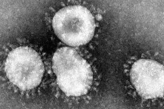 Eine Mikroskopaufnahme zeigt das Coronavirus