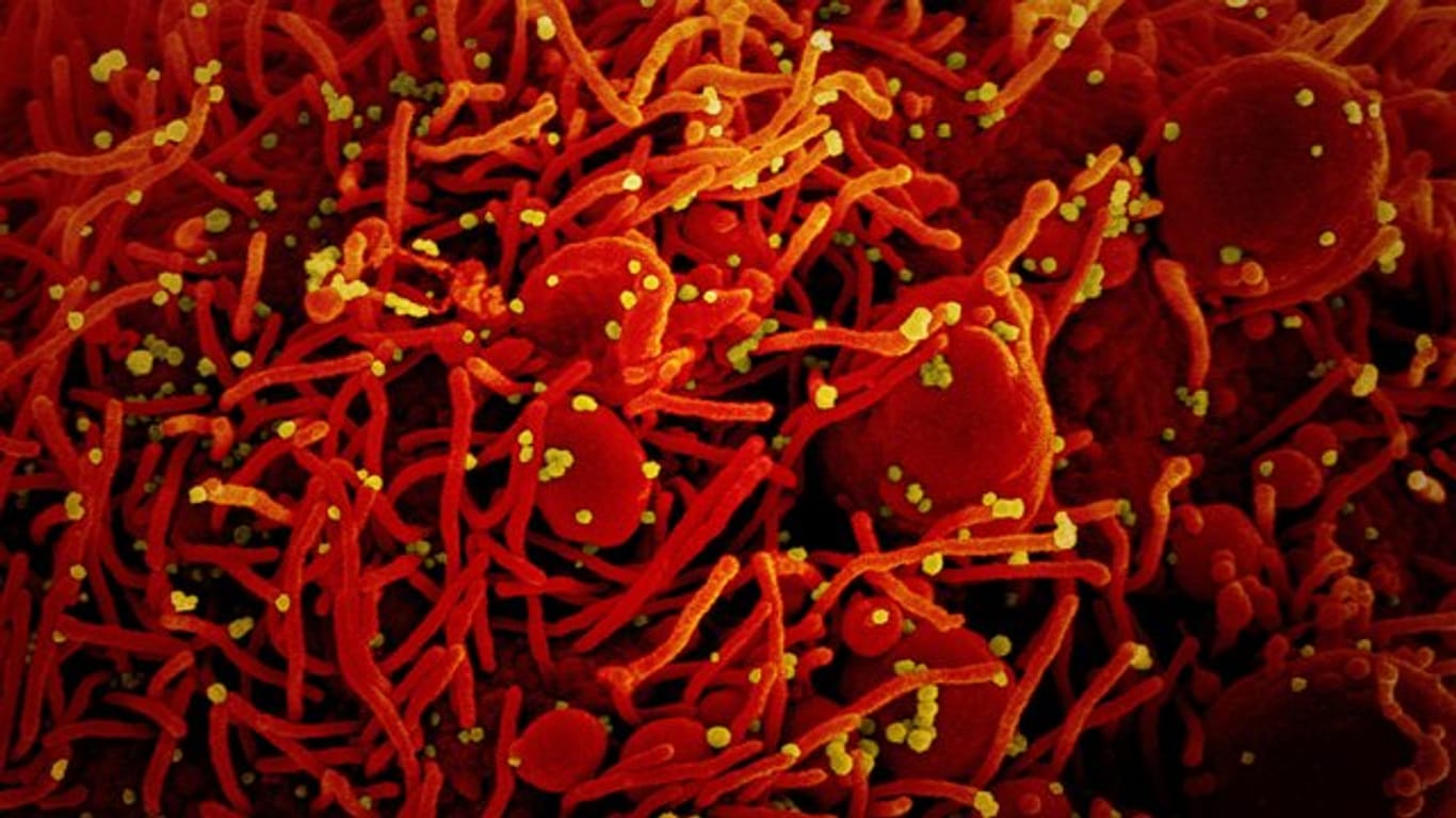 Eine Zelle (rot) mit dem Coronavirus (SARS-CoV-2, gelb) infiziert.