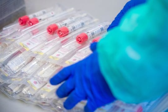 In der Fußball-Bundesliga werden die Spieler regelmäßig auf das Coronavirus getestet.