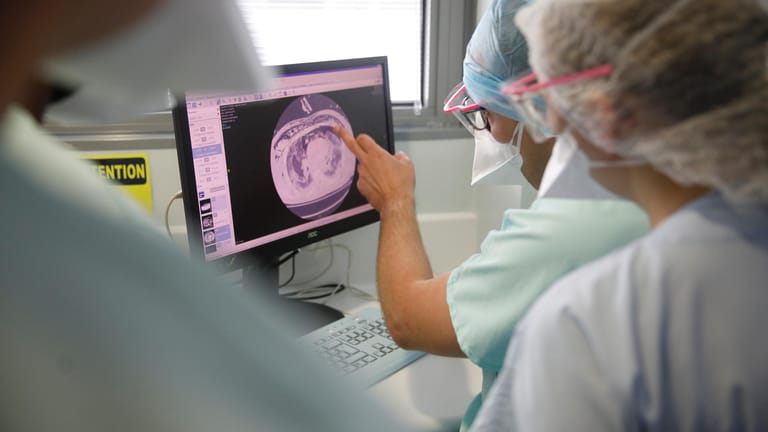 Straßburg: Medizinisches Personal bespricht ein Röntgenbild der Lunge eines Corona-Patienten im Nouvel Hopital Civil.