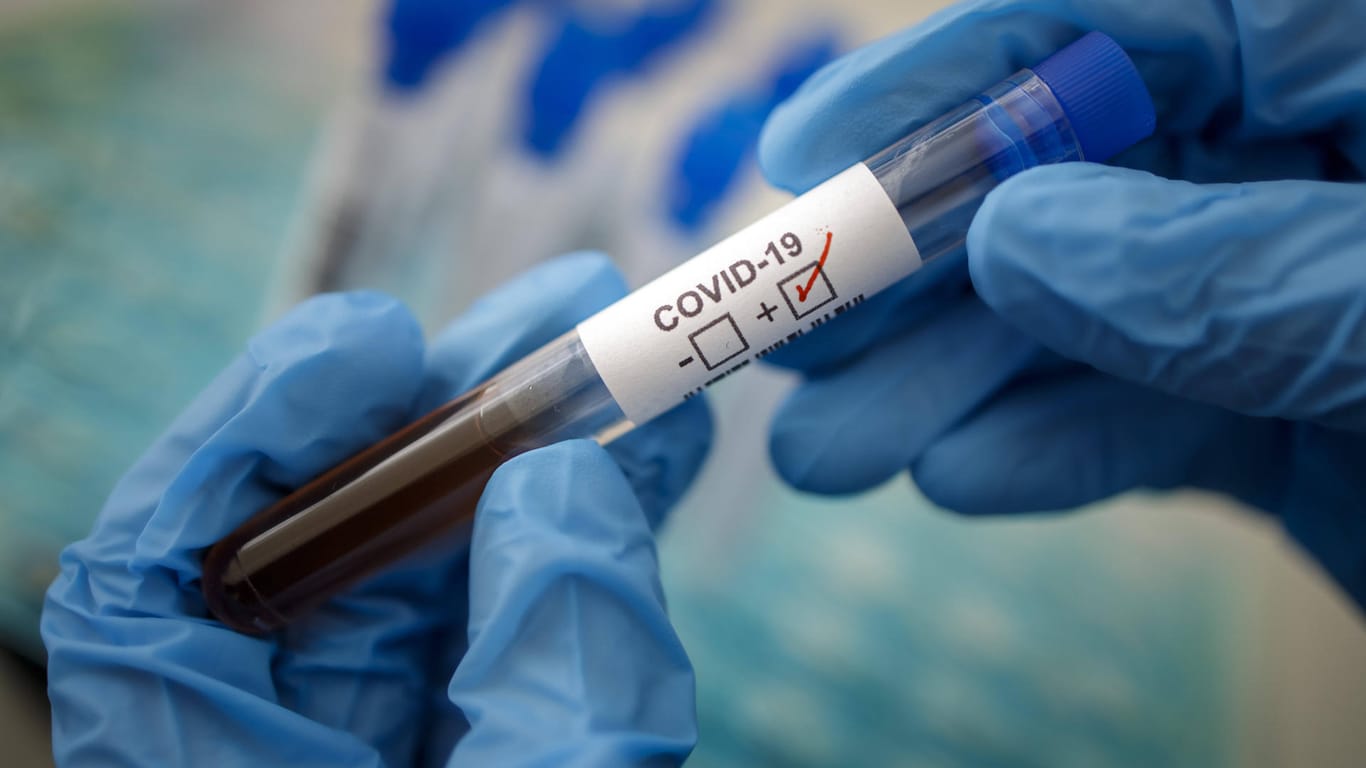 Coronavirus-Test in Deutschland: Erstmals sind an einem Tag mehr als 18.000 Menschen positiv getestet worden.
