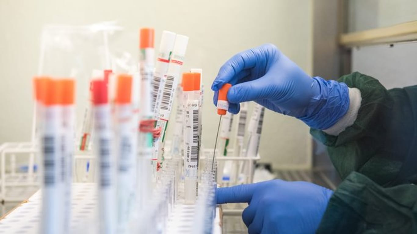 Nach Verbandsangaben sind die Testkapazitäten der Labore erstmals zu 100 Prozent ausgereizt.