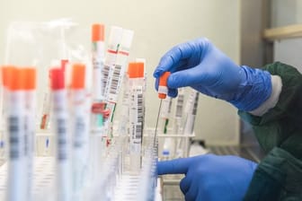 Nach Verbandsangaben sind die Testkapazitäten der Labore erstmals zu 100 Prozent ausgereizt.