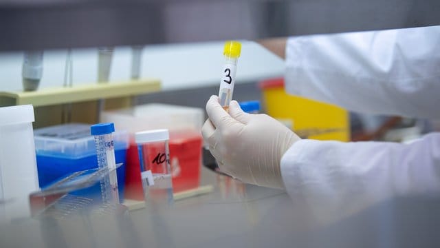 Eine Ärztin zeigt einen Test für das Coronavirus