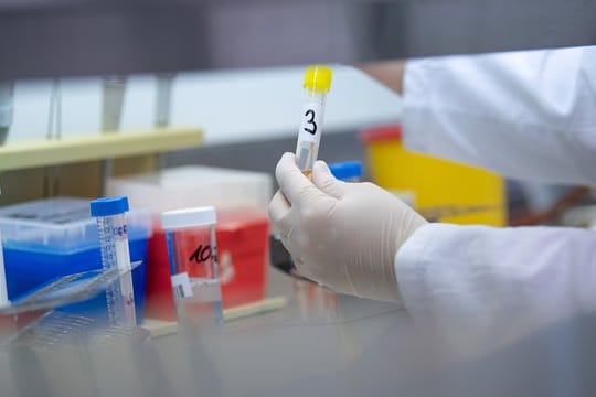 Eine Ärztin zeigt einen Test für das Coronavirus