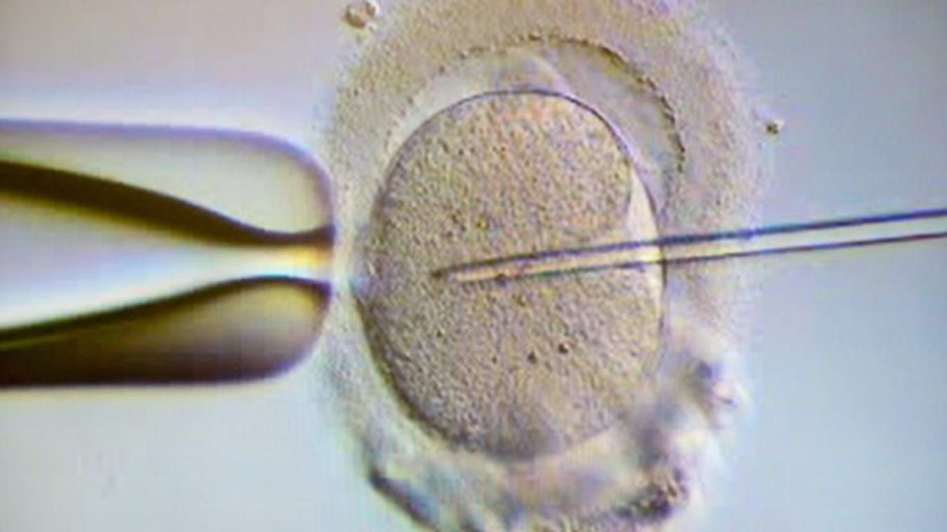 Ein Spermium wird einer Eizelle injiziert.