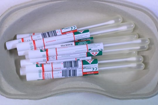 Corona-Labore kommen teilweise mit dem Auswerten der Tests nicht mehr hinterher.