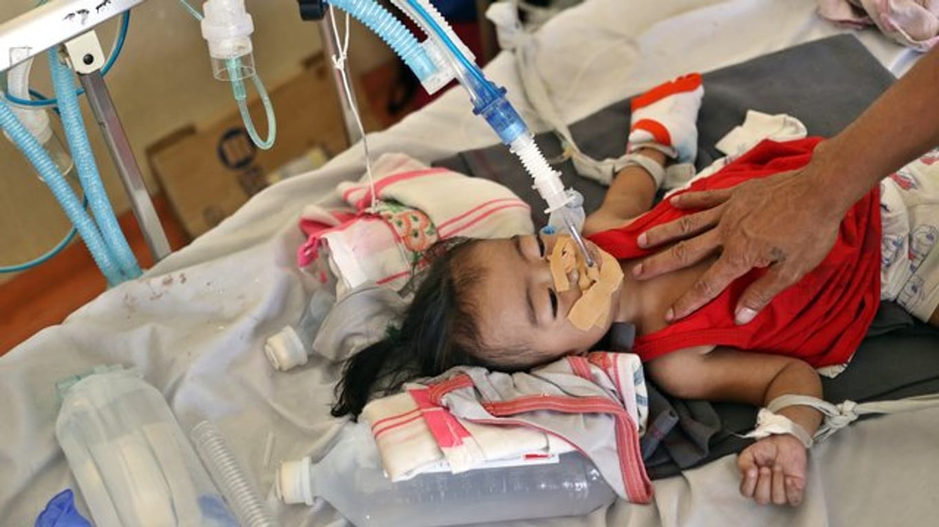 Masern: Ein philippinisches Kind wird in einem Krankenhaus in Manila behandelt.