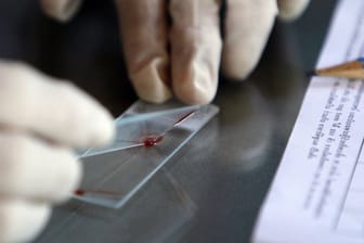 Die Weltgesundheitsorganisation (WHO) warnt vor Resistenzen von Malaria-Erregern gegen Medikamente in einigen asiatischen Ländern.