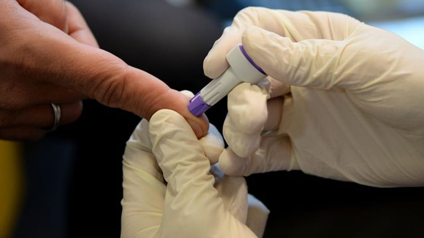 Blutabnahme für einen HIV-Test: In der Corona-Pandemie machen weniger Menschen einen solchen Test. (Symbolbild)