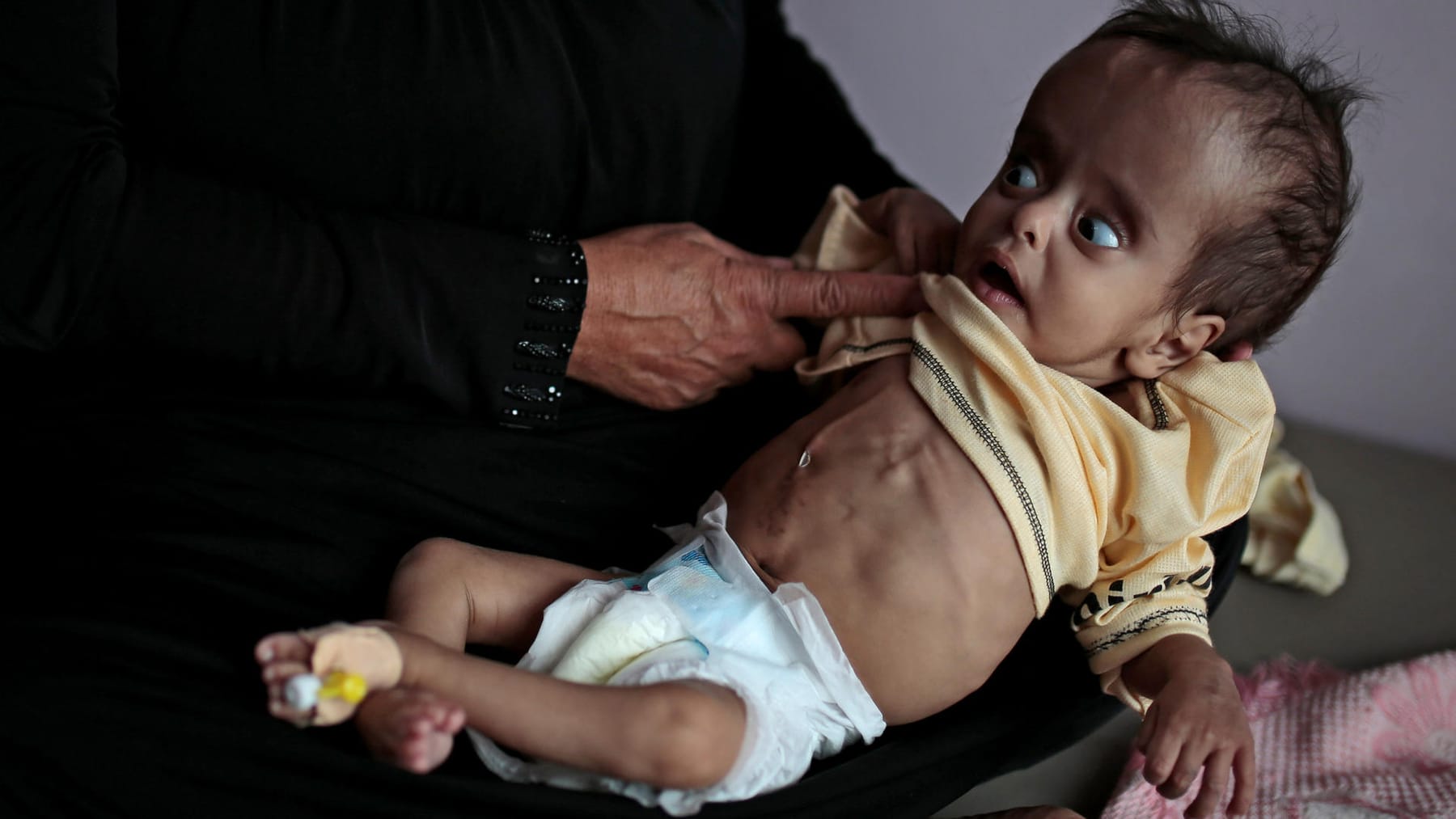 Wegen Trump Plan Im Jemen Droht Die Größte Hungersnot Seit Jahrzehnten 