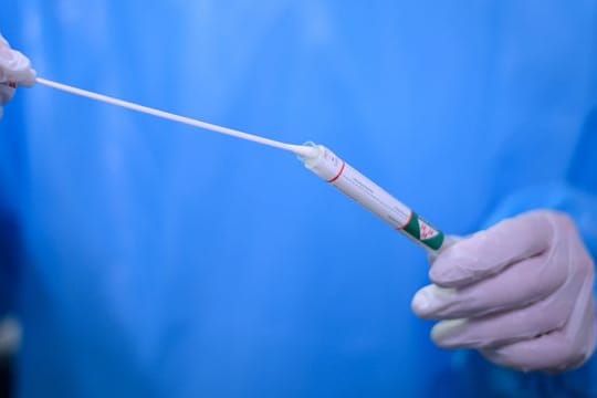 Ein Arzt hält einen Coronavirus-Test in den Händen