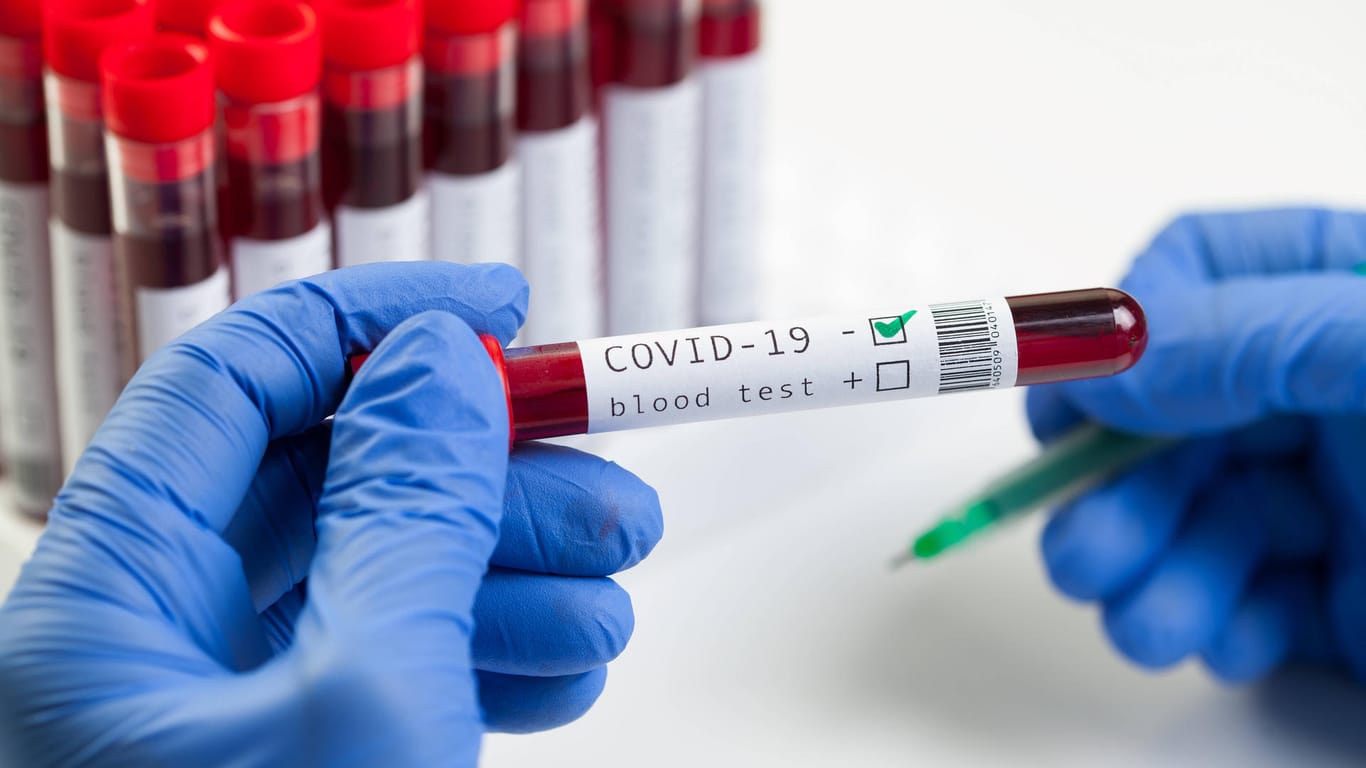 Ein positiver Corona-Test wird in der Hand gehalten (Symbolbild): Die zwei Kölner, die t-online über ihre Covid-19-Erkrankung berichtet haben, erlebten die Krankheit sehr unterschiedlich.