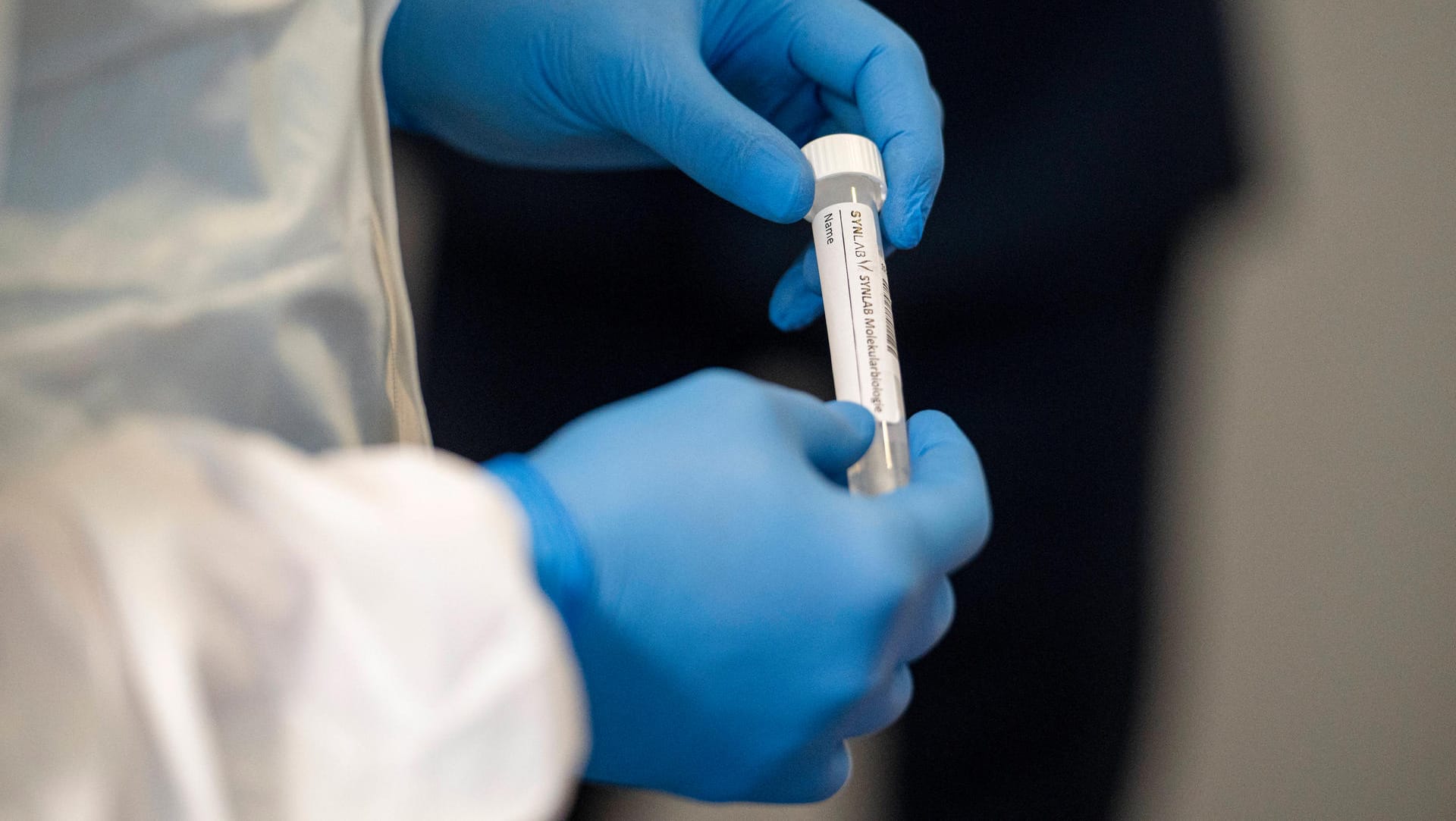 Corona-Tests in Deutschland: Das RKI musste die Fallzahlen für Donnerstag korrigieren. Corona-Tests in Deutschland: Das RKI musste die Fallzahlen für Donnerstag korrigieren.