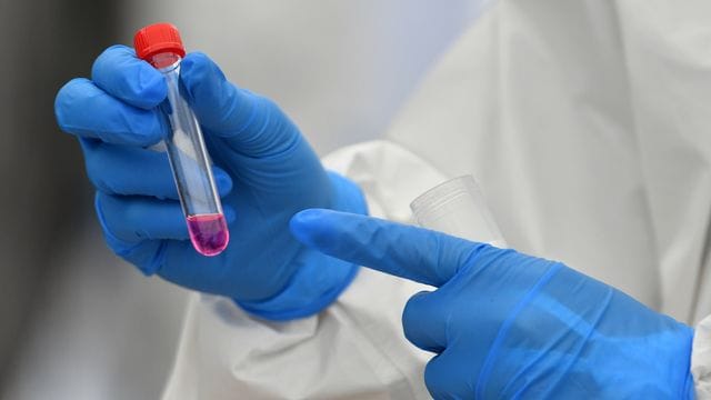 Eine Laborantin hält einen Corona-Test in der Hand Eine Laborantin hält einen Corona-Test in der Hand