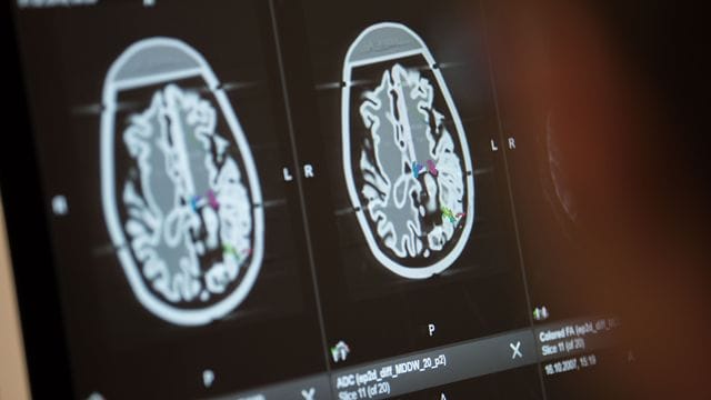 Symbolbild "Neurologie" Symbolbild "Neurologie"