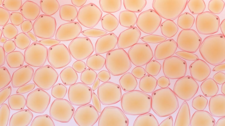 Miskroskopische Darstellung von braunem Fettgewebe: Anders als weiße Fettzellen, fördern braune die Kalorienverbrennung.