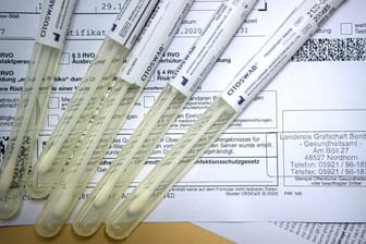 Proben für einen PCR-Test liegen in einem Corona-Testzentrum.