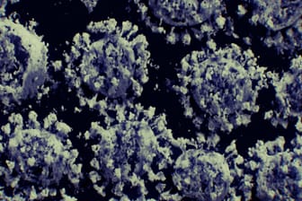Coronaviren: Es handelt sich hierbei nicht um computergenerierte Modelle, sondern um durch neue Techniken entstandene 3D-Abbildungen "echter" SARS-CoV-2-Viren aus schockgefrorenen Proben.