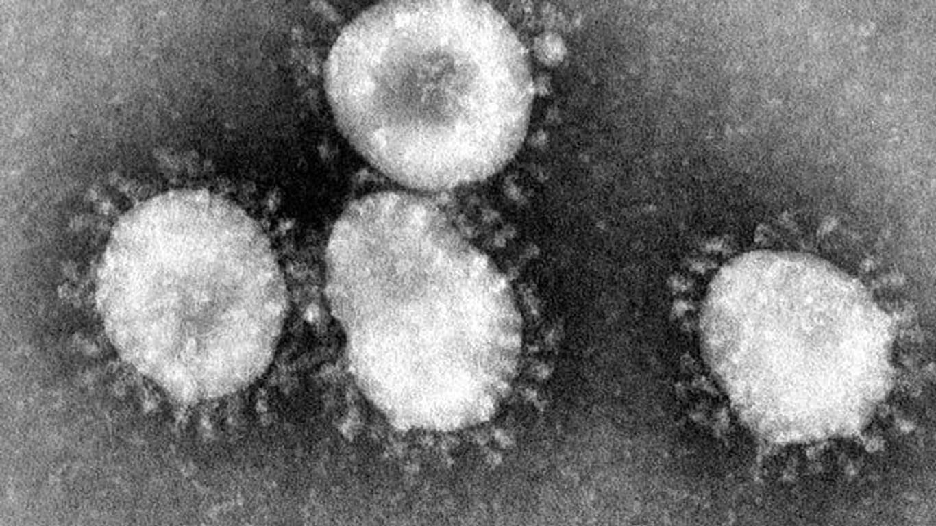 Eine Mikroskopaufnahme zeigt das Coronavirus (Archivbild): In Stuttgart ist die südafrikanische Variante des Coronavirus festgestellt worden.